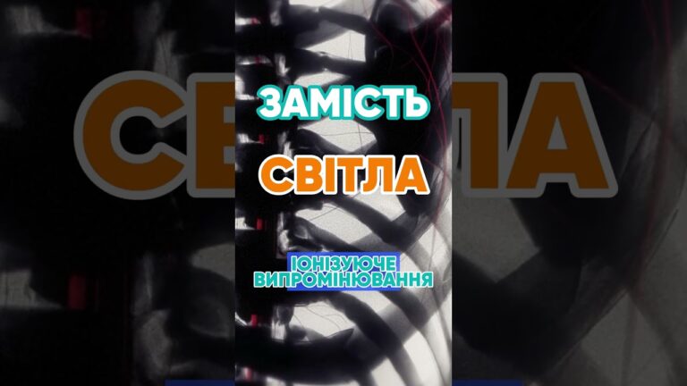 Чому рентген показує кістки? 🦴 #наука #цікаво #рентген #медицина