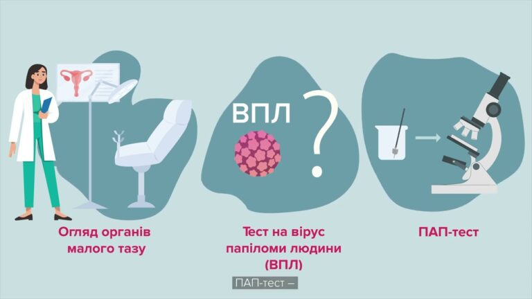 Фото для новини:Турбота про жіноче здоров’я починається з профілактики