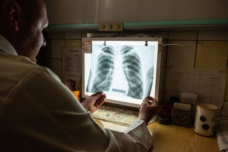 Фото для новини:В Україні з'являються випадки позалегеневого туберкульозу - ЦГЗ