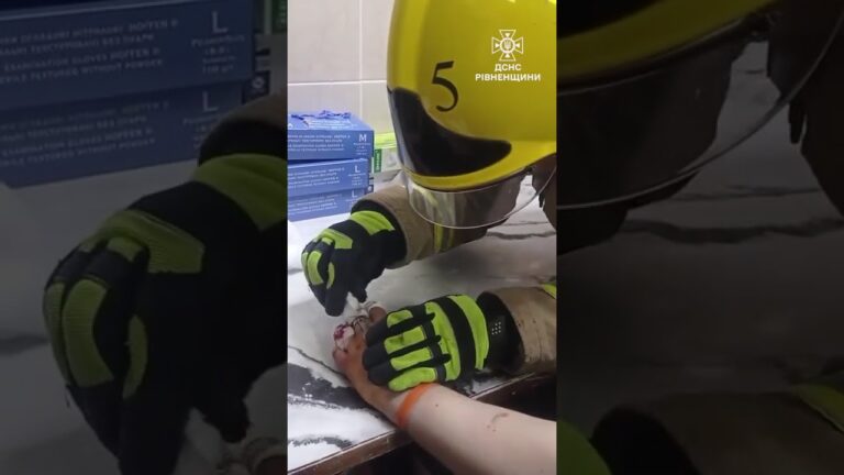 Фото для новини:Хірургічна точність: на Рівненщині рятувальники вивільнити палець підлітка із металевої «пастки»
