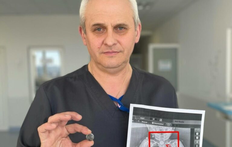 Фото для новини:У Львові врятували дитину, яка місяцями жила з батарейкою у стравоході