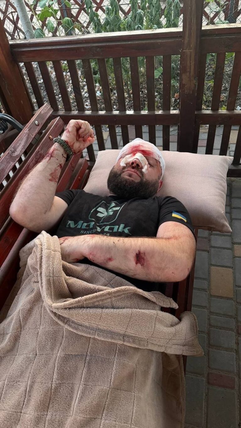 Фото для новини:На Одещині жорстоко побили військового за зауваження про російську музику