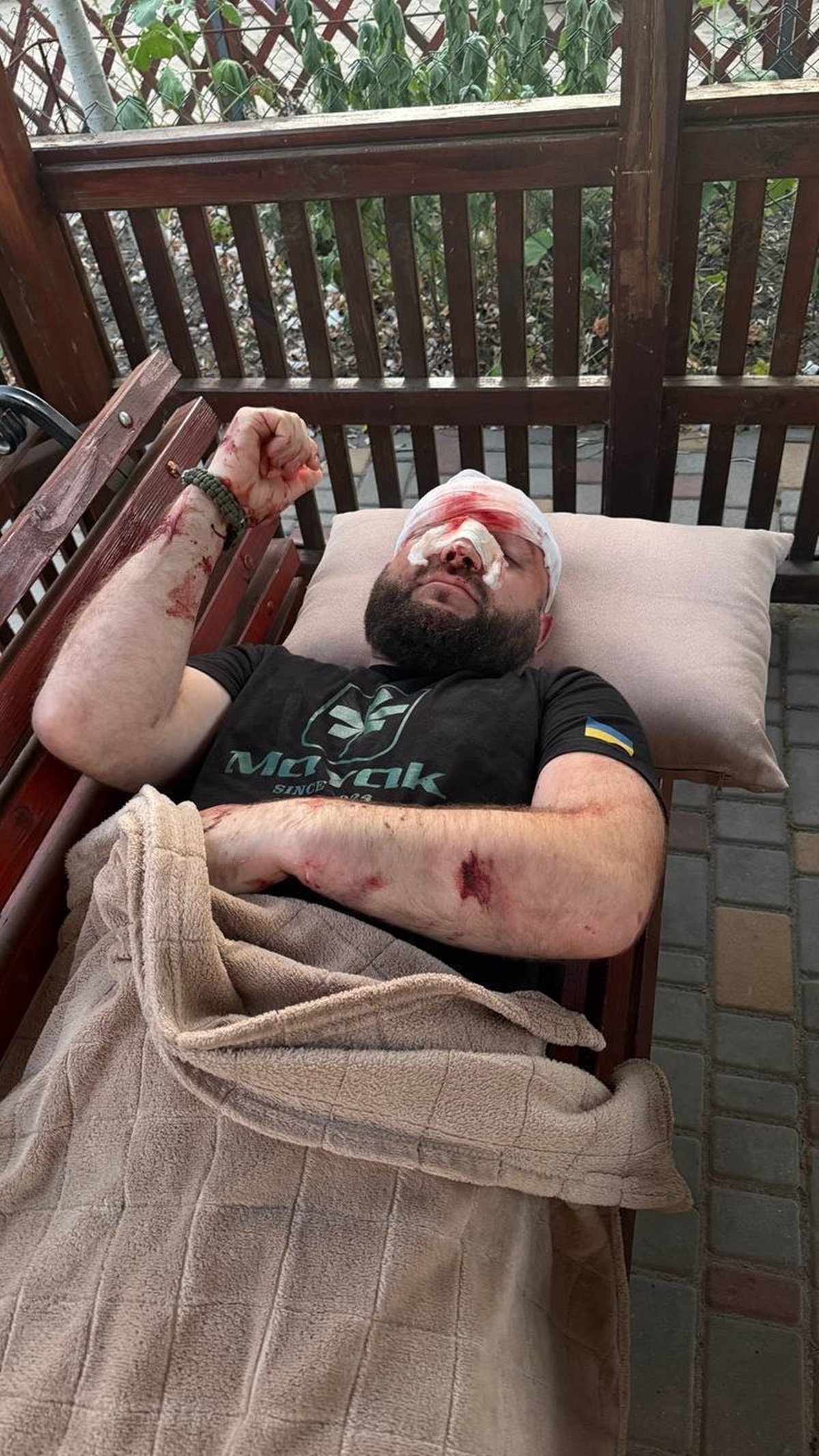 Фото для новини:На Одещині жорстоко побили військового за зауваження про російську музику