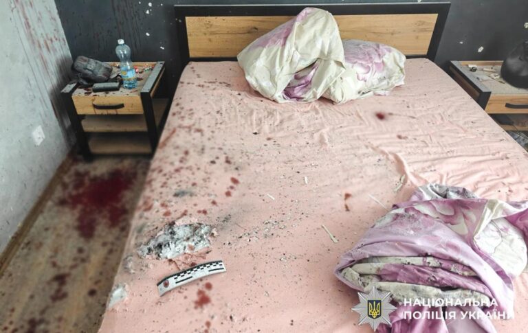Фото для новини:"Сувенір" із фронту: під Рівним через вибух гранати скалічилися студенти